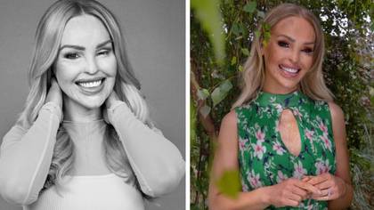 Katie Piper opens up about 'inspiring' people she meets each week through her burns survivors charity