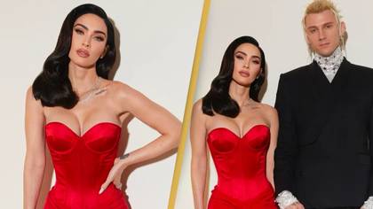 Megan Fox shows up to pre-Grammys party with broken wrist and concussion