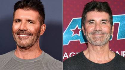 Simon Cowell opens up about what made him finally dissolve his facial fillers