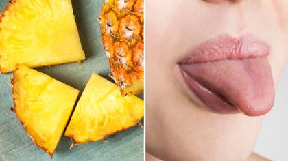 Disturbing reason your mouth tingles after eating pineapple