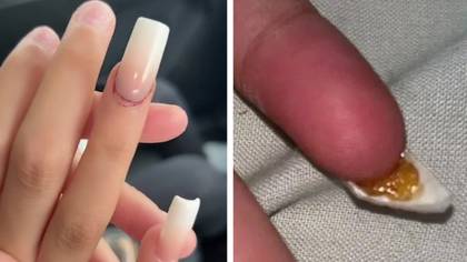 Mum issues warning to parents after allowing 10-year-old daughter to get acrylic nails