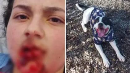 Girl, 12, suffers severe facial injuries after being mauled by her pet dog