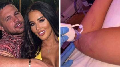 Yazmin Oukhellou shows off scars from car crash that killed her boyfriend