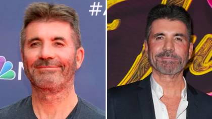Simon Cowell hits back at claims he's had facelift after Ant & Dec joke