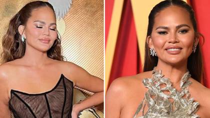 Fans praise Chrissy Teigen asking her to ‘never change’ after revealing surgery scars