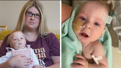 Baby with rare genetic condition has to wait more than five-months for NHS operation