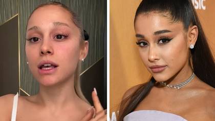 Ariana Grande holds back tears as she admits she had lip filler and Botox