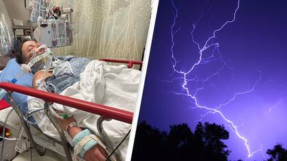 Woman who had to be brought ‘back to life’ after being struck by lightning speaks about experience