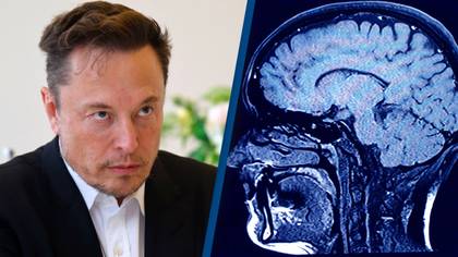 'Thousands of people' are lining up to be first volunteer to let Elon Musk’s robot insert wires inside their skull