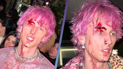 Machine Gun Kelly Shares Bloody Photos With Fans After Smashing Glass On His Face