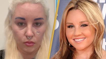 Amanda Bynes reveals she had bleph surgery after fans questions her appearance changing