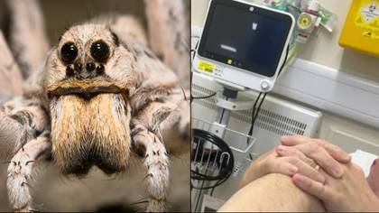 Man claims a spider laid eggs inside his toe during cruise and hatched baby inside it