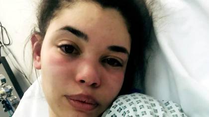Woman With Endometriosis Put Into Early Menopause Aged 19 