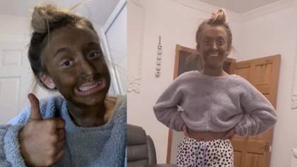 Mum Left In Stitches After Teenage Daughter's Fake Tan Fail
