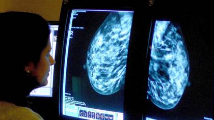 Women Should Be Offered Mammograms And Smear Tests On Lunch Breaks, New Report States