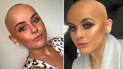 Woman With Alopecia Shares Inspirational Message To Encourage Others To Ditch Their Wigs