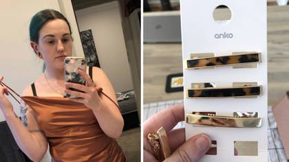 Melbourne Woman Is Praised For 'Genius' £2 Hairclip Hack That Transformed Her Dress