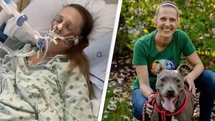 Woman On Life Support After Dog Headbutted Her While Playing