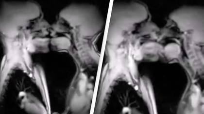 People disturbed by MRI of couple kissing