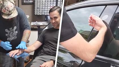 Man implants his Tesla car key in his hand so he never loses it