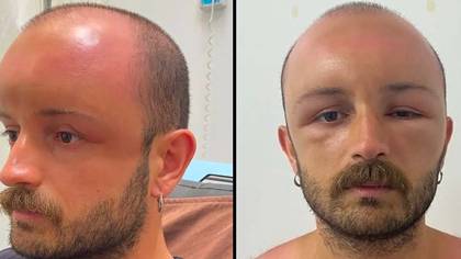 Doctors shocked after man's head swells to double the size