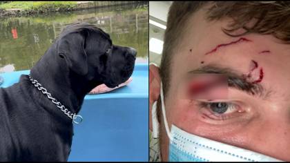 Lad jumps into a lake to save dog that later savages his face