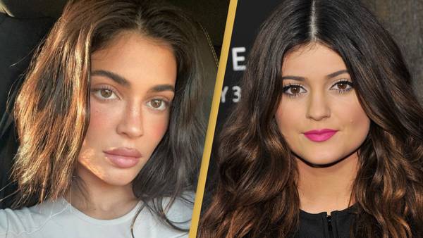 Kylie Jenner explains why she looks so different in before and after photos and says it's not plastic surgery
