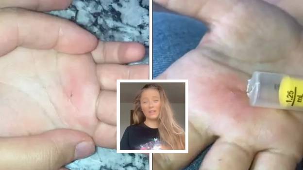 Mum Applauded For Clever Trick To Easily Remove Splinters