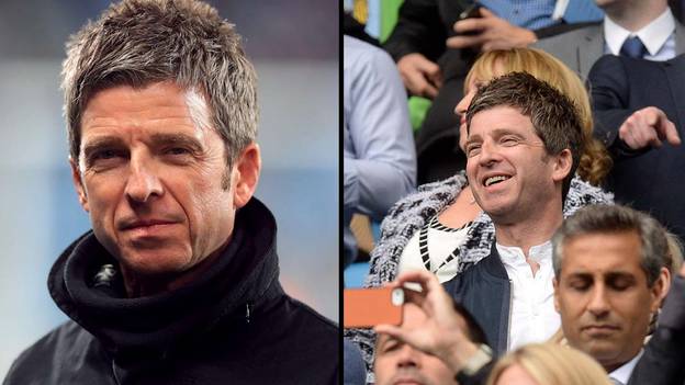 Noel Gallagher Left Needing Stitches With Two Black Eyes After Headbutt During City Game