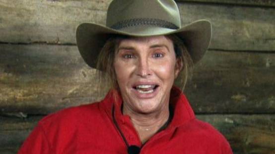 Kendall Jenner Finally Posts Support For Caitlyn On ‘I’m A Celebrity’