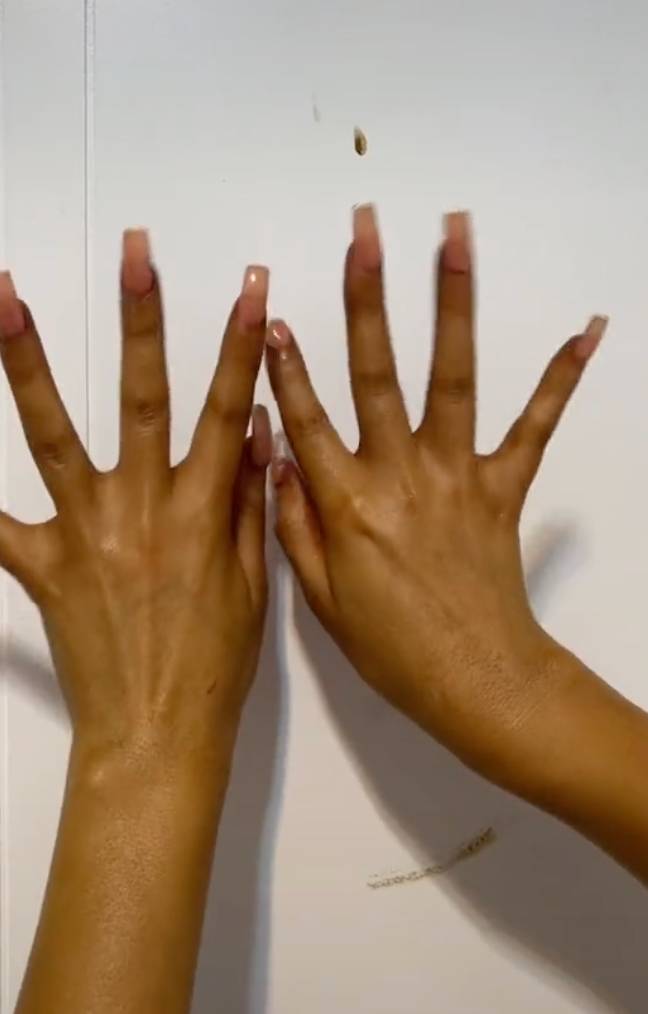 The routine left the palms of the hands very tanned. Credit: TikTok/@hondroutwins