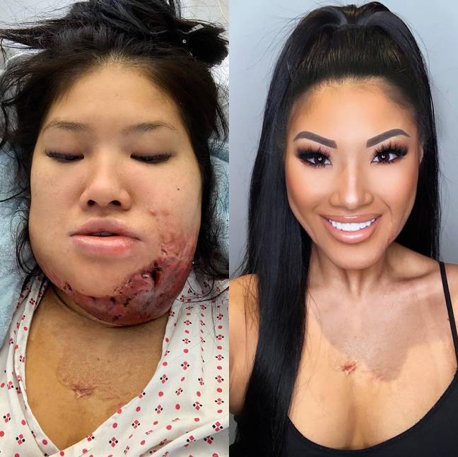 Sophie Lee said the accident ultimately made her into a better woman. Credit: Instagram/@sophirelee