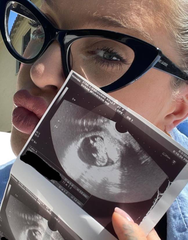 Kelly announced her pregnancy back in May. Credit: @kellyosbourne/Instagram