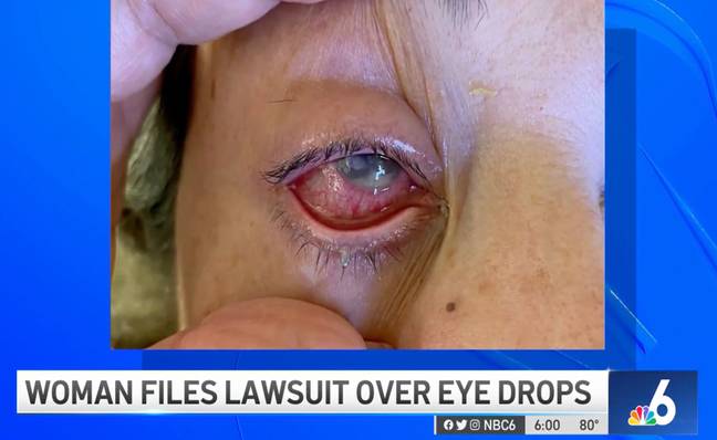 Her eye worsened to the point where it had to be removed, leaving her legally blind. Credit: NBC