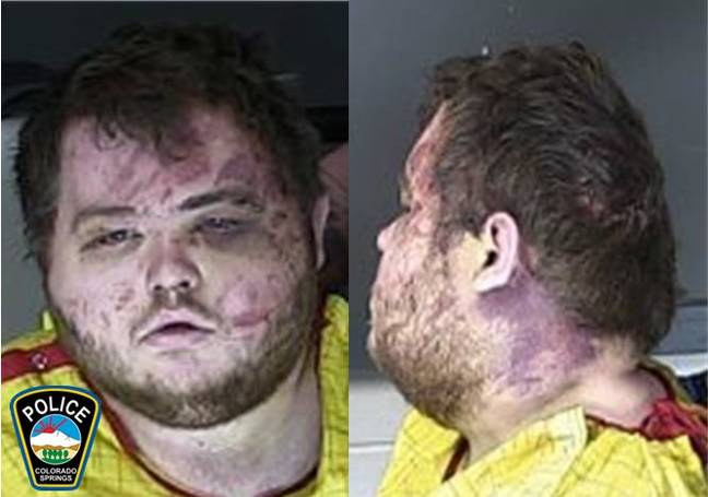 A mugshot of the Colorado nightclub suspect shows them with a beaten and bruised face. Credit: @CSPDPIO/Twitter