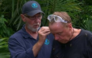 Medic Bob removing a cockroach from Harry Redknapp's ear. Credit: ITV