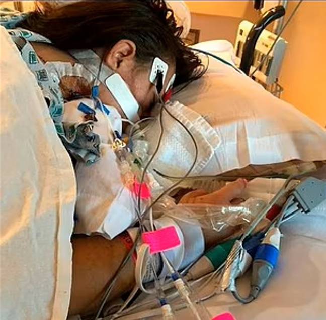 Amanda was put on life support for eight days after vaping. Credit: Amanda Stelzer/SWNS