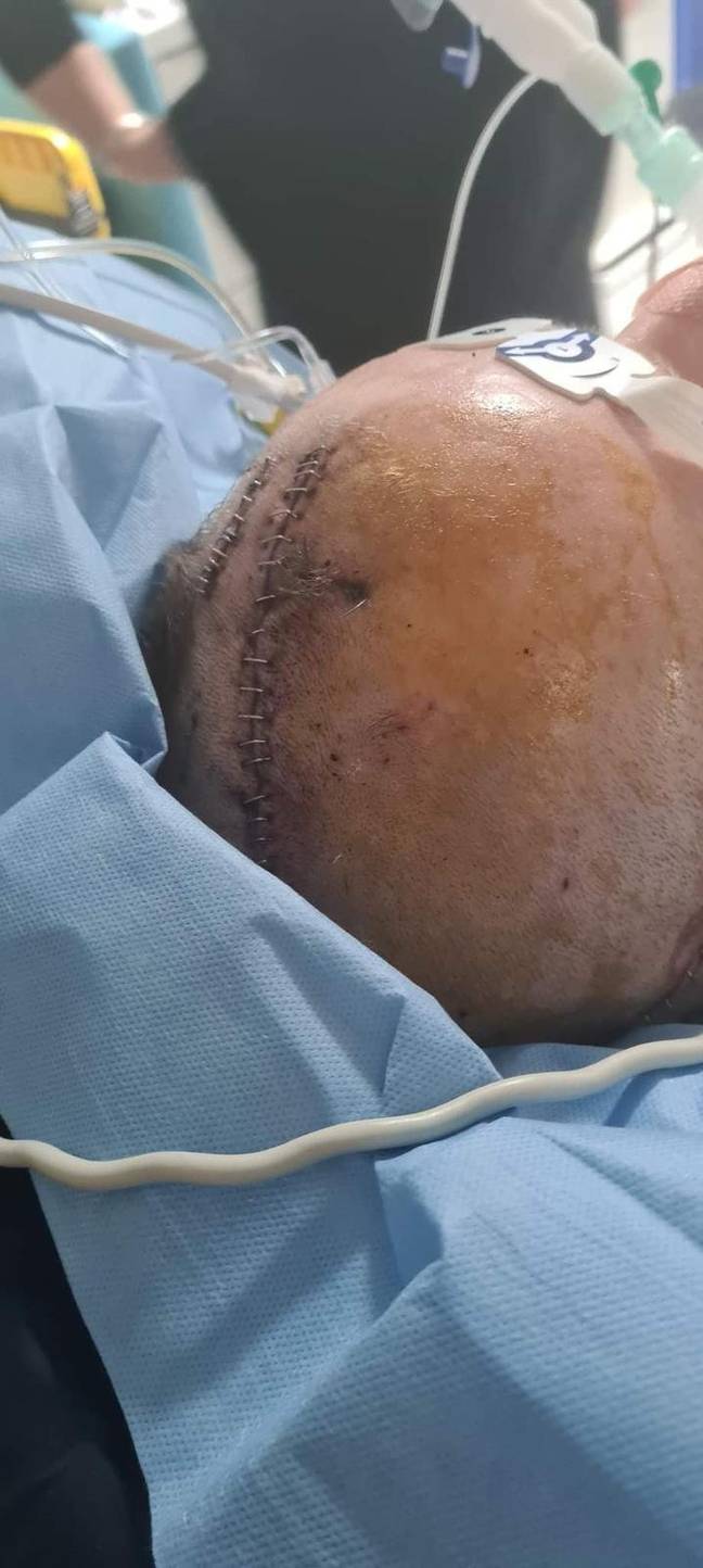 Braden said he feels like his life has been 'put on hold' because of the attack. Credit: SWNS