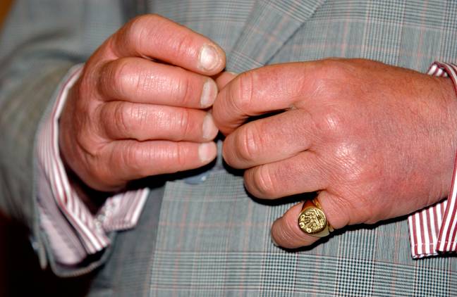 People want to know why King Charles III's hands look so swollen. Credit: Jack Sullivan / Alamy Stock Photo