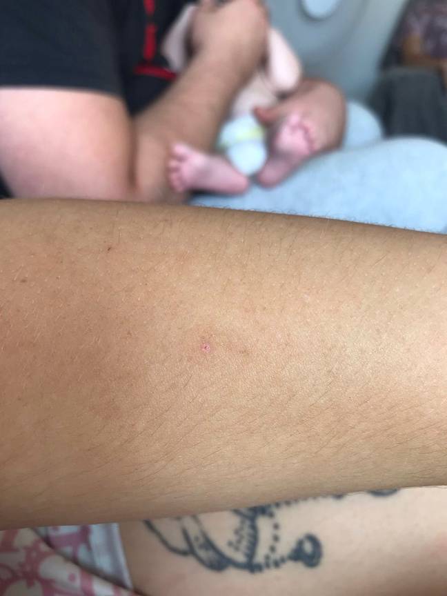 Tammie-Michelle found a needle mark in her arm after the incident. Credit: SWNS