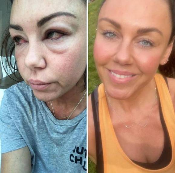 Michelle shared this before and after (Credit: Instagram/ Michelle Heaton)