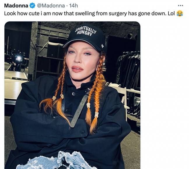 Madonna said she'd had surgery. Credit: Twitter@madonna