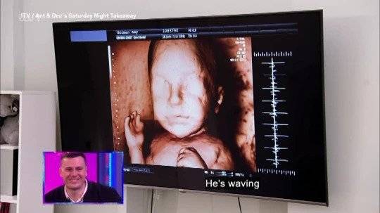 Viewers were not left pleased by the scan prank. Credit: ITV 