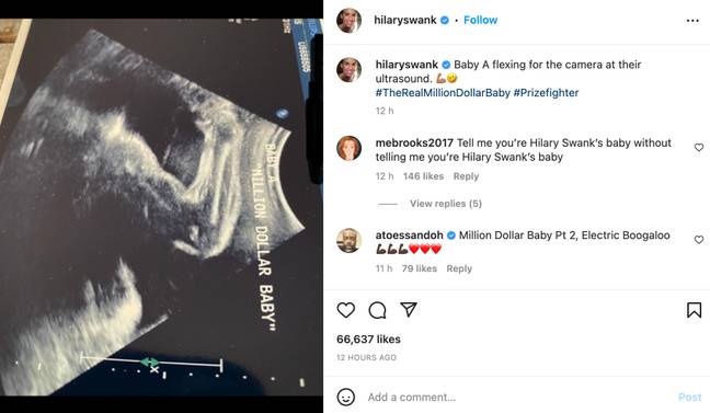  The baby can be seen flexing an arm in the ultrasound. Credit: Instagram/@hilaryswank