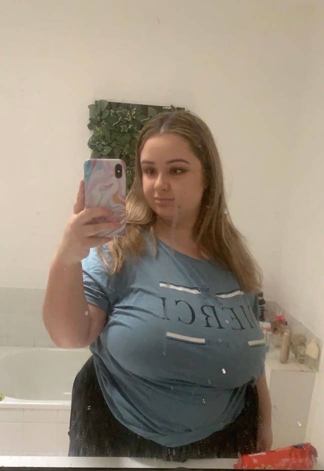 Woman with 44GG sizedgets breast reduction following years of Woman with 44GG sizedgets breast reduction following years of