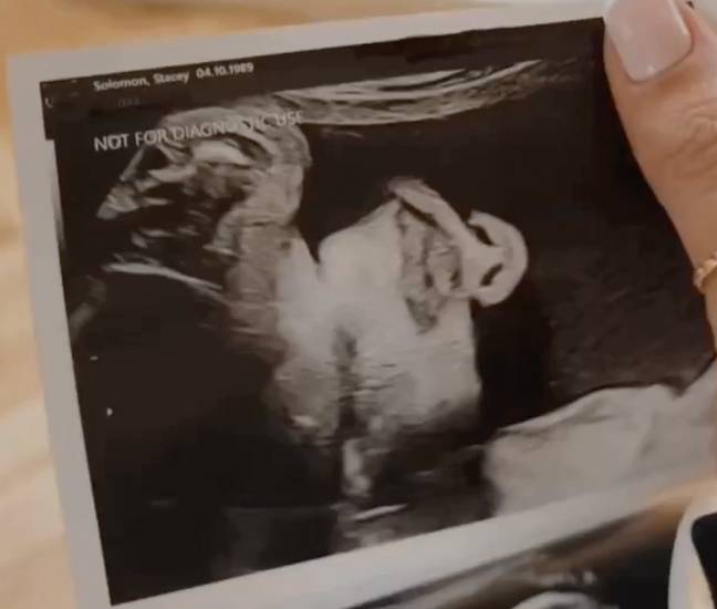 Stacey revealed the sonogram to followers. Credit: @staceysolomon/Instagram
