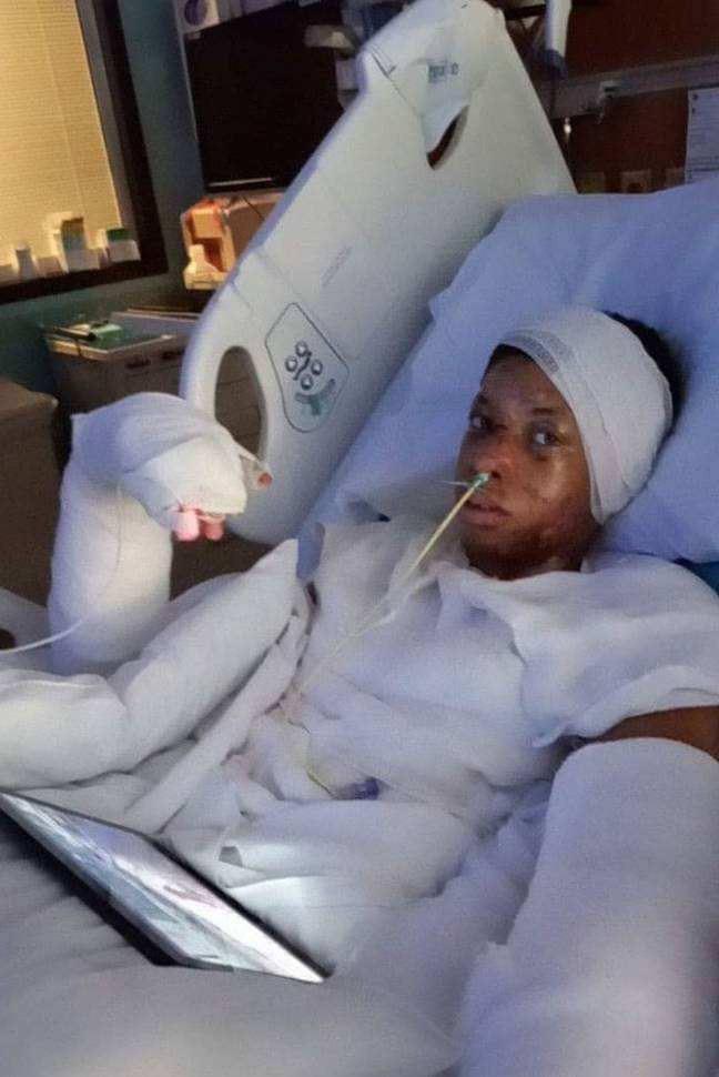 Tiffany Crutcher's 13-year-old son Dzhyan was left with serious burns after pouring alcohol over a candle like a stunt he'd seen on social media. Credit: Kennedy News and Media