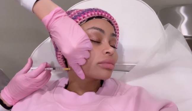 She had filler dissolver injected into her face. Credit: Instagram/@blacchyna
