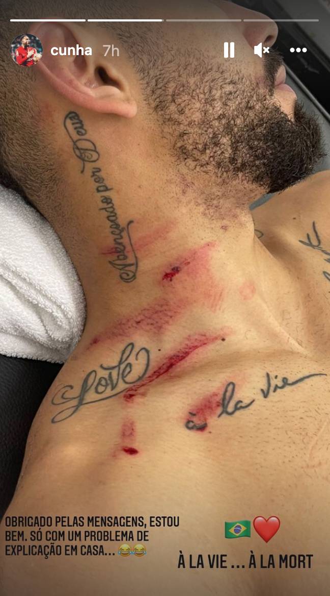 Cunha certainly took a nasty kick. Image: Instagram