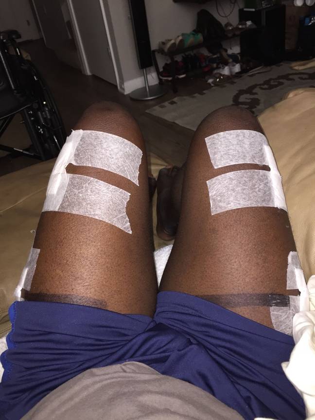 Moses had another surgery last month. Credit: Kennedy News and Media